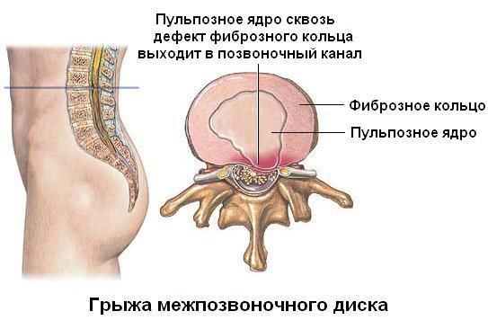53058b0112ed3
